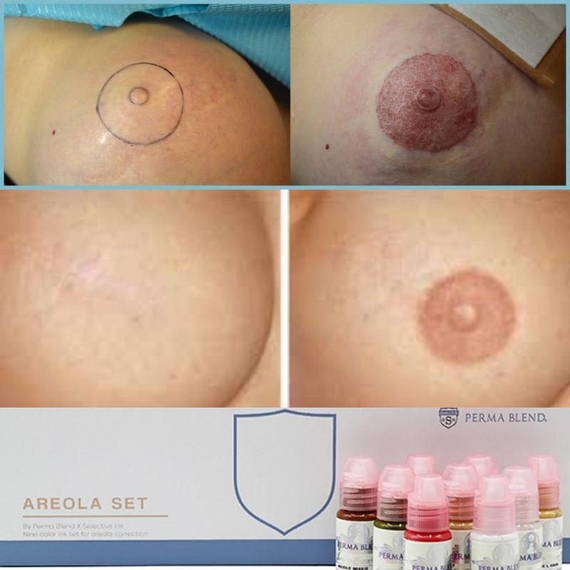 3D Areola Nipple Tattooing - Areola Repigmentation – AZPMU